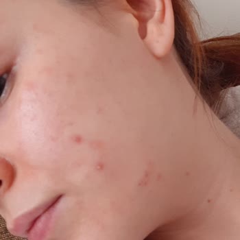 Licape Kozmetik Licape Markasi Yüzümü Mahvetti