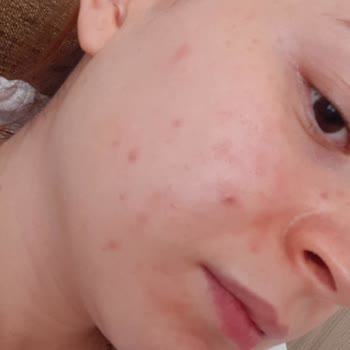 Licape Kozmetik Licape Markasi Yüzümü Mahvetti