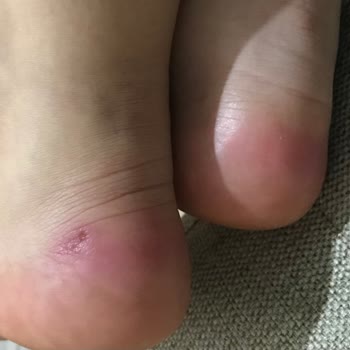 Vans Ayakkabı Vans Old Skool Problemi.