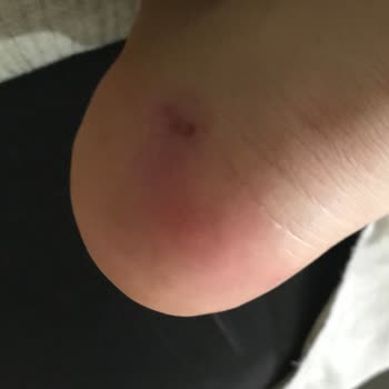 Vans Ayakkabı Vans Old Skool Problemi.