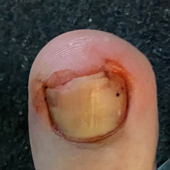 In Street Kusurlu Ürün Ve İade Hakkının Olmaması