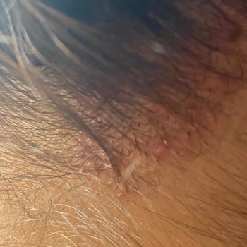 Kronos Kuaför Saçlarım Yara İçinde Kaldı