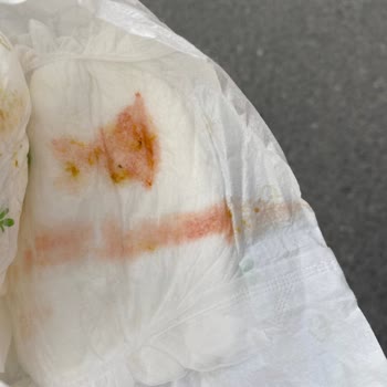 Medigold Hastanesi Hastane Hemşiresinin Tavırları