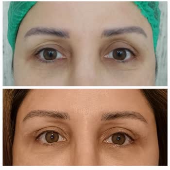 Sym Estetik Uyuşturmadan Canlı Canlı Kestiler Beni