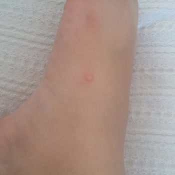 Zara Terlik İade İncelenme Alınmaması