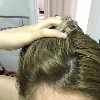 Elseve Mor Şampuan Dore Şikayeti