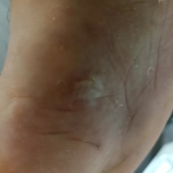 Kinetix Ayakkabılarda Kullanılan Boya Ya Da Yapıştırıcı Kimyasal.