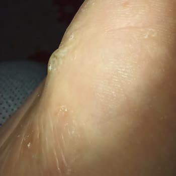 Kinetix Ayakkabılarda Kullanılan Boya Ya Da Yapıştırıcı Kimyasal.