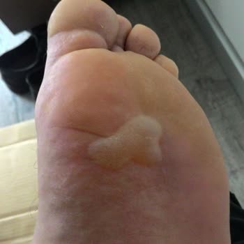 Kinetix Ayakkabılarda Kullanılan Boya Ya Da Yapıştırıcı Kimyasal.