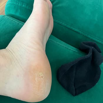 Derimod Mağazasından Aldığım Ayakkabı Ayağımı Rahatsız Etti