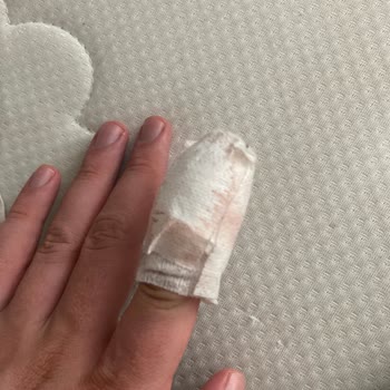 Reyap Hastanesi Esenyurt Haksız Ücret Alındı