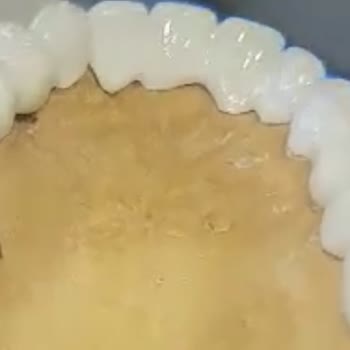 Dentanorm Dental İmplant İşlemimde Yaşadığım Sorunlar