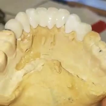 Dentanorm Dental İmplant İşlemimde Yaşadığım Sorunlar