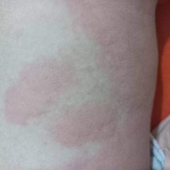 Sütaş Bozuk Ürün Daha Ne Olsun...