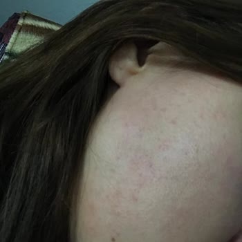 Sinoz Pink Touch Pembe Güneş Kremi