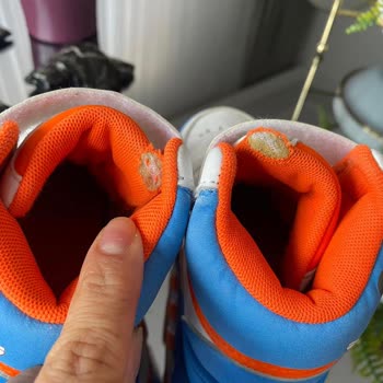 Adidas Çocuk Ayakkabısı Firma Kusuru Kendinin Kabul Etmiyor