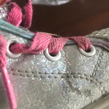 Skechers Ürünün Arkasında Durmuyor!