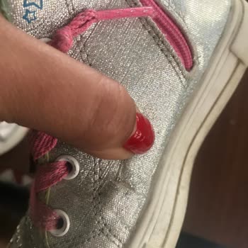 Skechers Ürünün Arkasında Durmuyor!