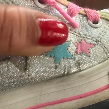 Skechers Ürünün Arkasında Durmuyor!