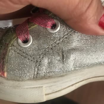 Skechers Ürünün Arkasında Durmuyor!