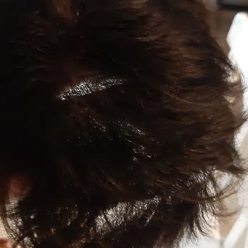 Tap Hair Türkiye Cadde Bostan Mağduriyet!