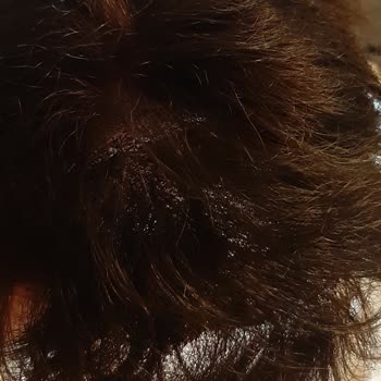 Tap Hair Türkiye Cadde Bostan Mağduriyet!