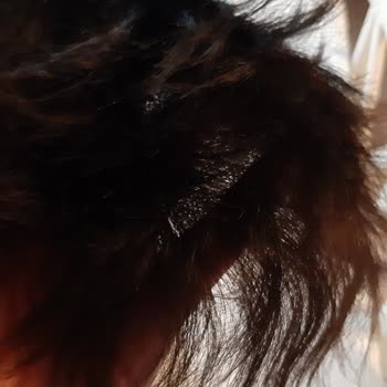 Tap Hair Türkiye Cadde Bostan Mağduriyet!