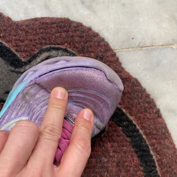 Skechers Spor Ayakkabısı 1 Ay Dolmadan Önden Ve Yandan Açılma Yaptı