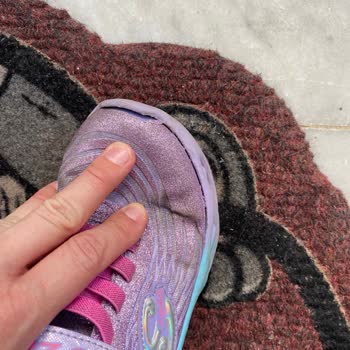 Skechers Spor Ayakkabısı 1 Ay Dolmadan Önden Ve Yandan Açılma Yaptı