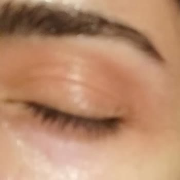 Gratis Likit Kapatıcı Alerji Yapıyor