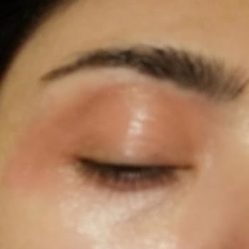 Gratis Likit Kapatıcı Alerji Yapıyor