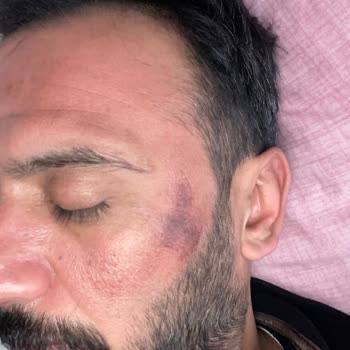 Heaven Deluxe Eryaman'da Yosun Peeling Pişmanlığı