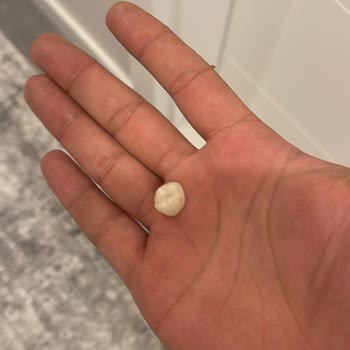 International Plus Yaptıkları Dişler Sürekli Çıkıyor ve İlgilenmiyorlar