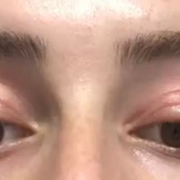 SHE Vec Ve Alerjik İçerikleri