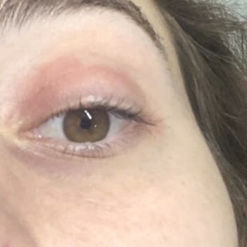 SHE Vec Ve Alerjik İçerikleri