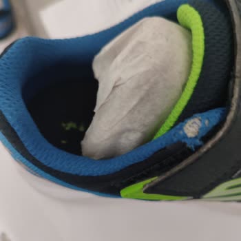 Skechers Ayıplı Ürün Gönderimi Yaptı