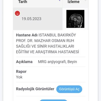 Bakırköy Dr. Sadi Konuk Eğitim ve Araştırma Hastanesi MR Rapor Hala Çıkmadı