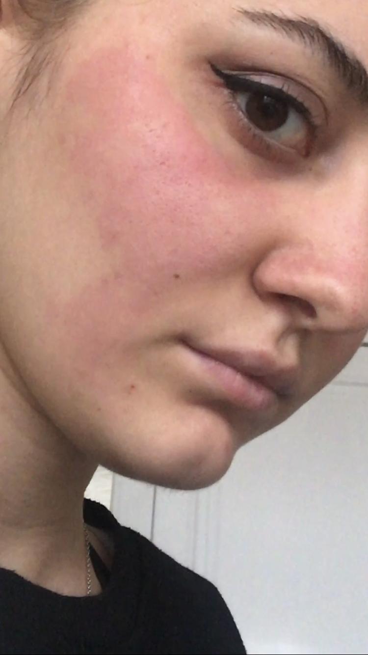 Newgen Serum İçin Şikayet Şikayetvar