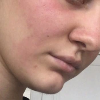 Newgen Serum İçin Şikayet