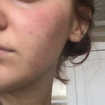 Newgen Serum İçin Şikayet