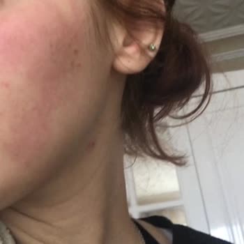 Newgen Serum İçin Şikayet