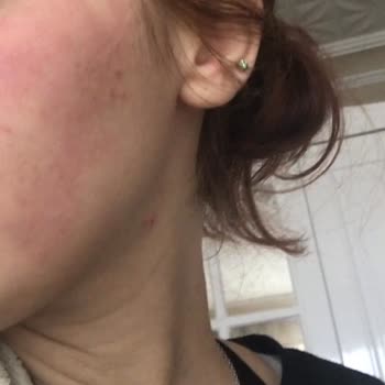 Newgen Serum İçin Şikayet