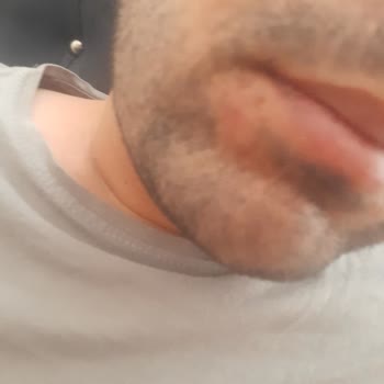 Lila Life Şanlıurfa Merkezinde Yaşanan Sorunlar