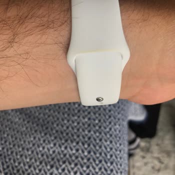Apple Watch Beyaz Kordon Sarardı