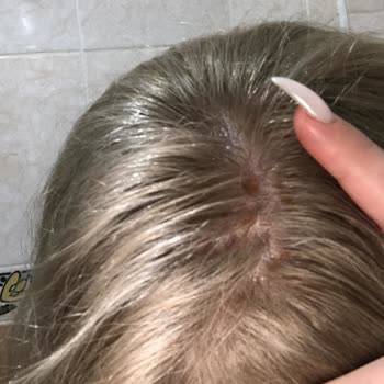 Loreal Paris Saç Boyası 8.11