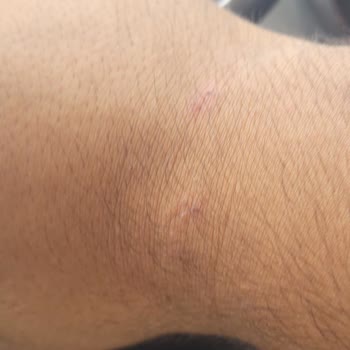 Lee Cooper London Saat Soyulup Yara Yapıyor