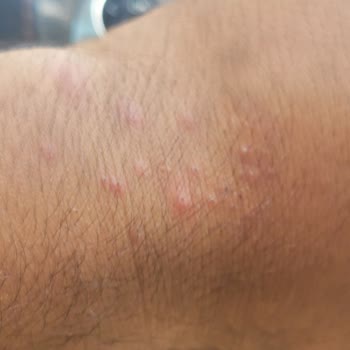 Lee Cooper London Saat Soyulup Yara Yapıyor