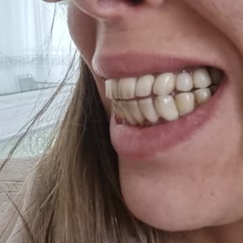 Zeos Ağız Ve Diş Sağlığı Polikliniği Hekim Seçme Özgürlüğü