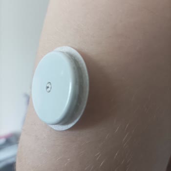 Freestyle Libre Libre Appi Telefonuma Güncelleme Geldikten Sonra Okumamaya Başladı