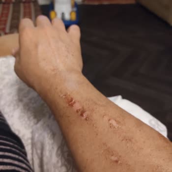 Bahar Acar Güzellik Merkezi Mersin En Başından Beri Kaba Ve İlgisiz Davrandılar